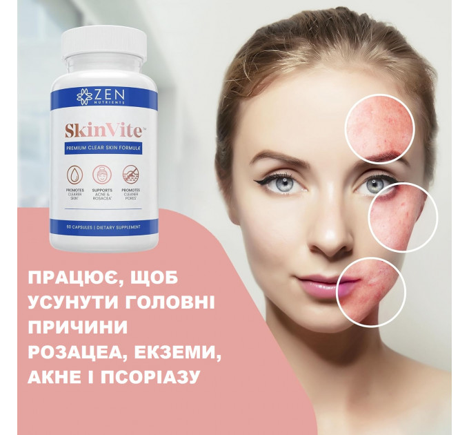 Витамины для чистой кожи Zen Nutrients SkinVite от акне розацеа єкземы псориаза (60 капсул)