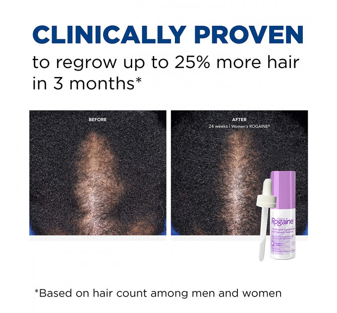 Розчин міноксидилу для росту волосся Women's Rogaine 2% Minoxidil для жінок
