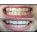 Полоски для отбеливания зубов Crest 3D Whitestrips Supreme Bright 1 шт (1 полоска для верхних и 1 для нижних зубов)