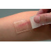 Силіконовий гелевий пластир для лікування шрамів та рубців CICA-CARE (12x15 см)