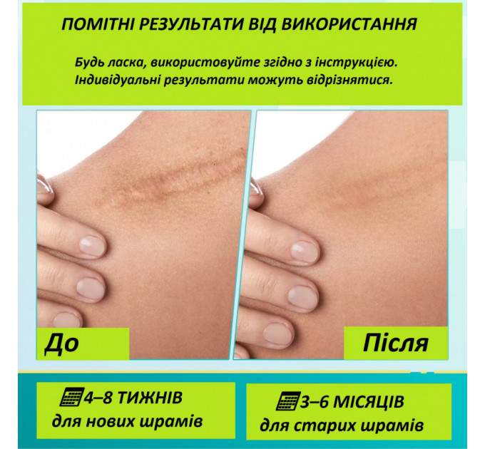 Гель силіконовий від розтяжок і рубців AirroYE 50 г