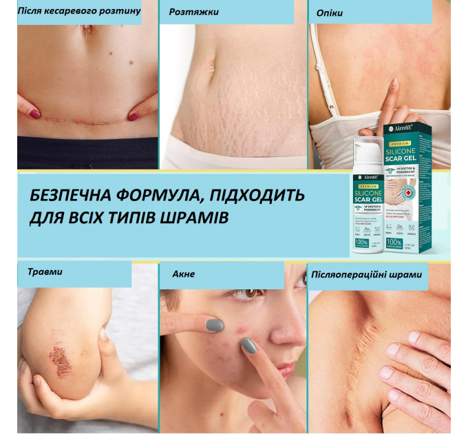 Гель силіконовий від розтяжок і рубців AirroYE 50 г
