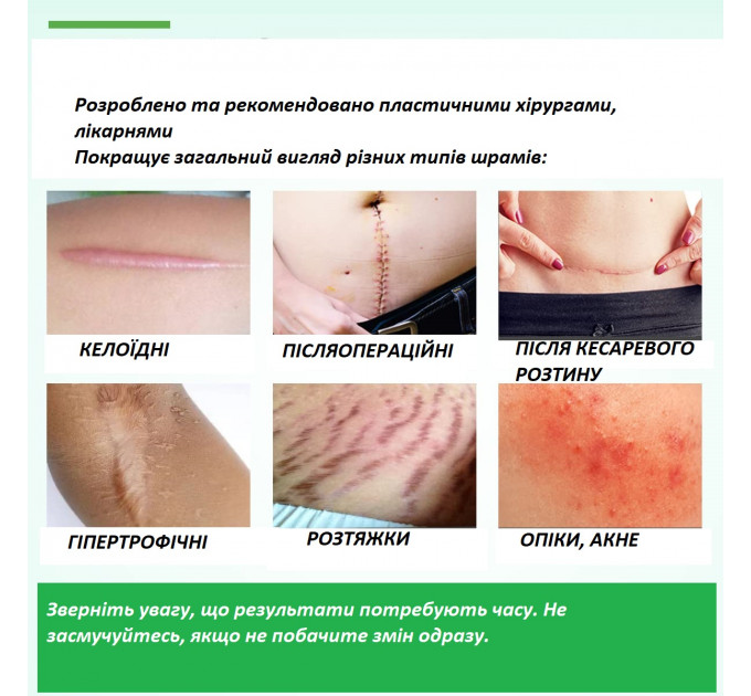Два комплекта пластырей Elaimei в рулоне 4,6 см х 4 м и полосками 15x4 см