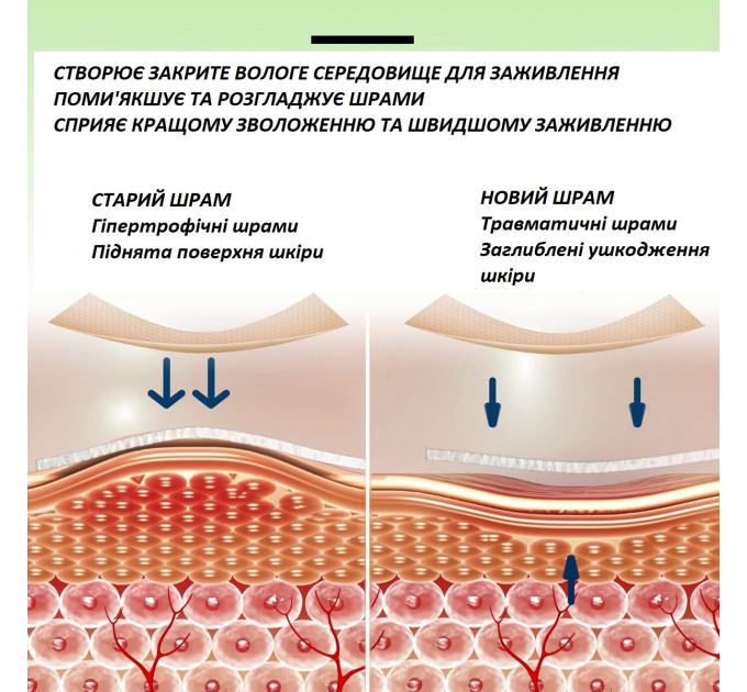 Два комплекта пластырей Elaimei в рулоне 4,6 см х 4 м и полосками 15x4 см