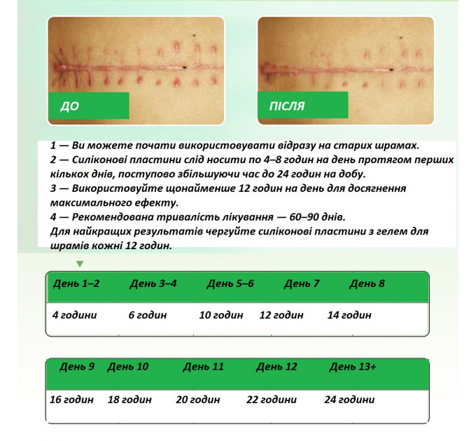 Два комплекта пластырей Elaimei в рулоне 4,6 см х 4 м и полосками 15x4 см