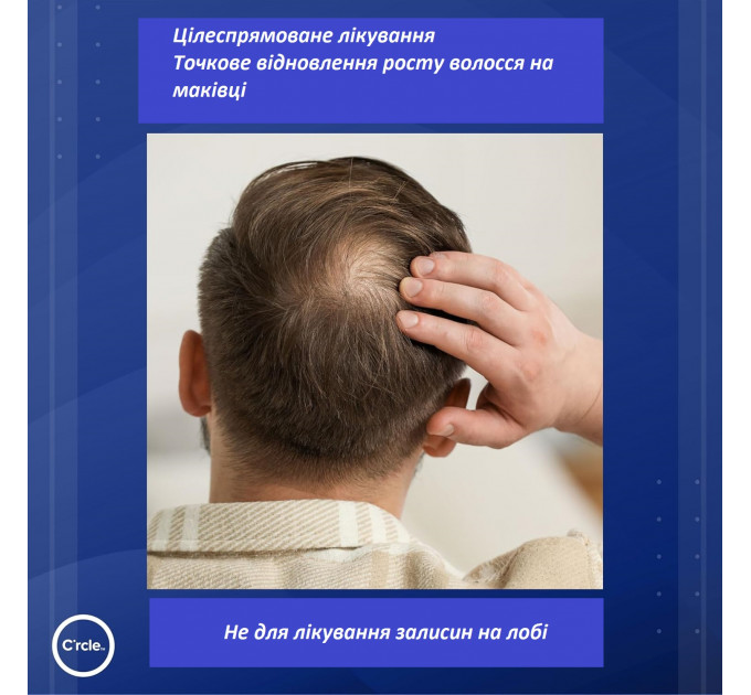 Двокомпонентна піна-лосьйон C'rcle REGOXIDINE 5% проти випадіння волосся і залисин у чоловіків 1 флакон 60 г