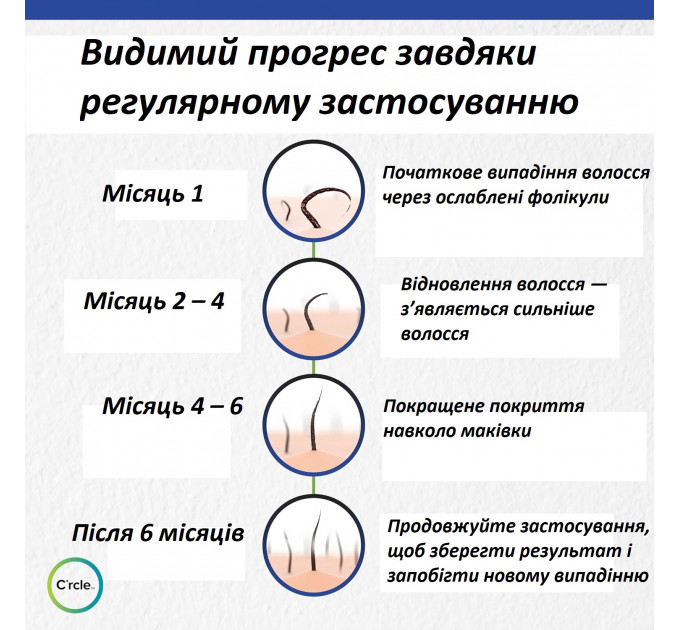 Двокомпонентна піна-лосьйон C'rcle REGOXIDINE 5% проти випадіння волосся і залисин у чоловіків 1 флакон 60 г