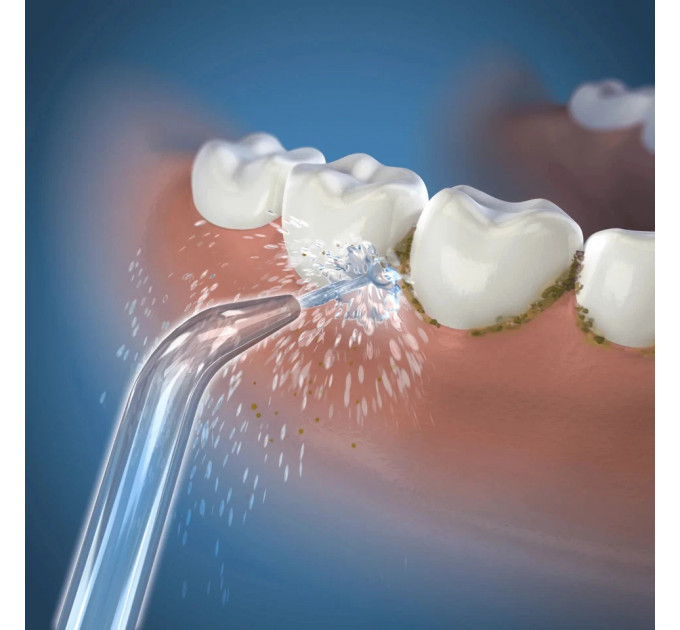 Комплект змінних насадок Waterpik JT-100E для іригаторів WP-100–950 2 шт