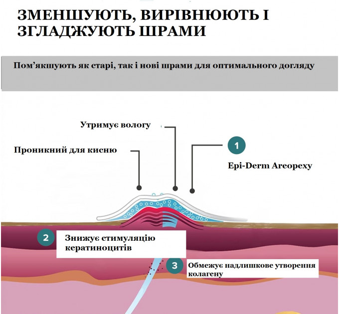 Силиконовый пластырь от шрамов после маммопластики Epi-Derm Areopexy (1 пара) прозрачный