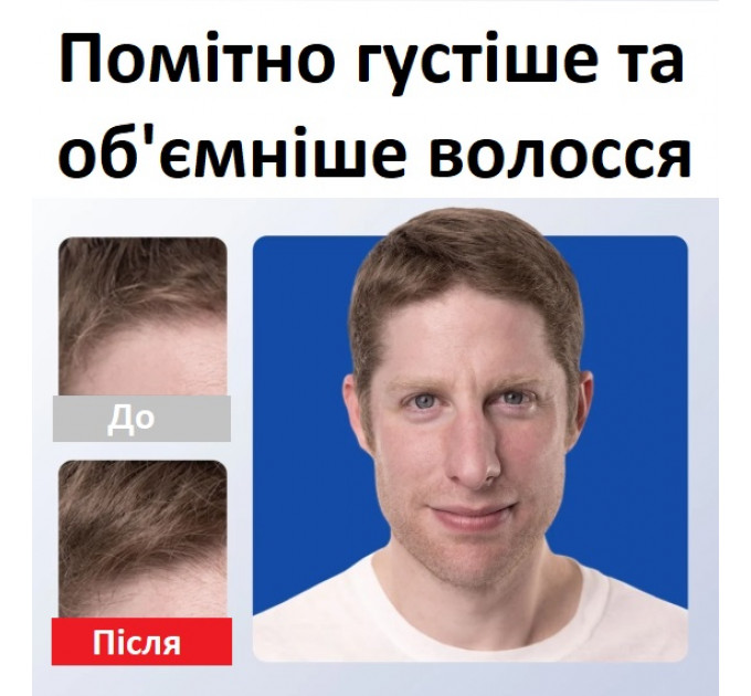 Шампунь-кондиціонер для чоловіків Rogaine 2 в 1 від випадіння волосся 248 мл
