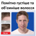 Шампунь-кондиціонер для чоловіків Rogaine 2 в 1 від випадіння волосся 248 мл