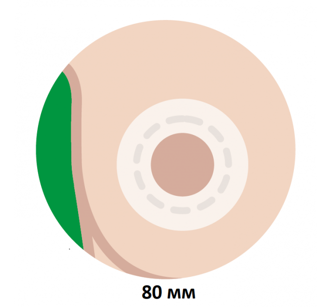 Круглый пластырь против послеоперационных рубцов на груди Improscar Patch 80 мм