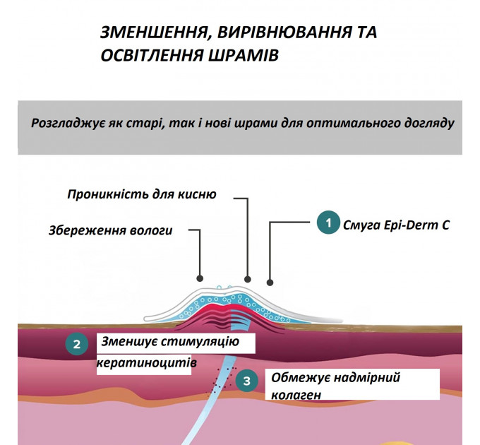 Силіконовий пластир від шрамів та рубців Epi-Derm C-Strip (3,6 х 15 см)