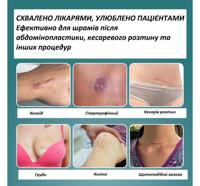 Силіконовий пластир від шрамів та рубців Epi-Derm C-Strip (3,6 х 15 см)