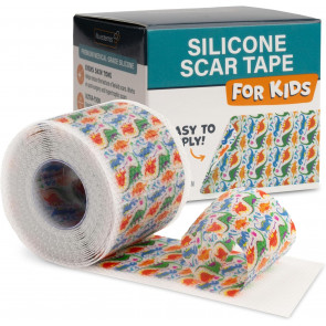 Дитячий силіконовий пластир для загоєння шрамів і рубців Nuvadermis 4х300см