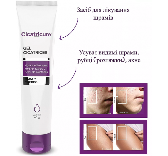 Гель от шрамов и рубцов Cicatricure Gel 30г