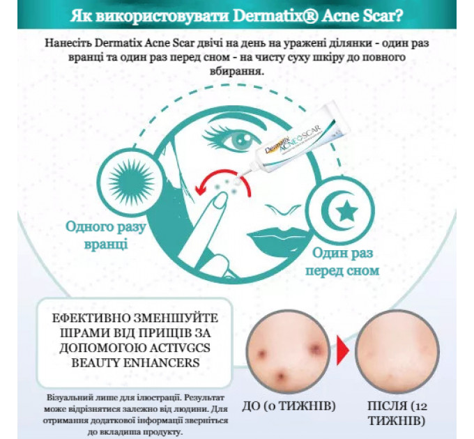 Гель для заживления акне и шрамов Dermatix ACNE SCAR 5г 